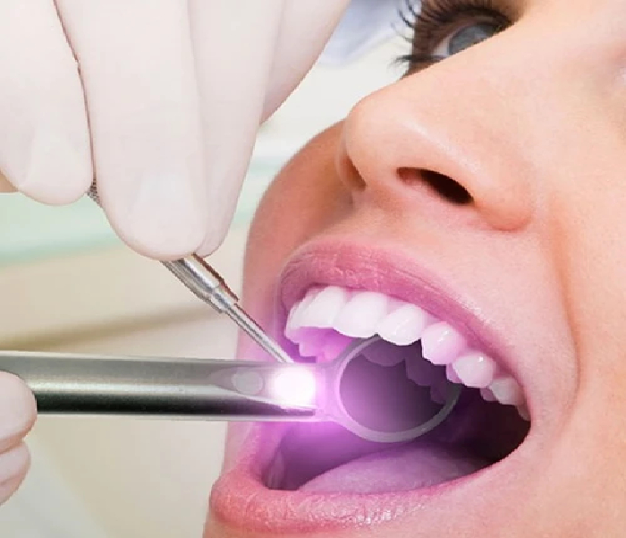 Oral Cancer Screening